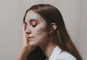 facelift recovery