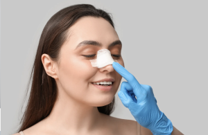 Rhinoplasty Recovery Time